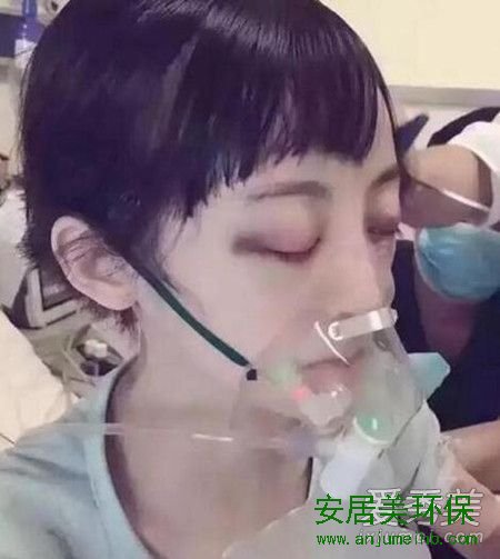 徐婷死因真相甲醛中毒？甲醛中毒的早期症状 甲醛中毒的表现